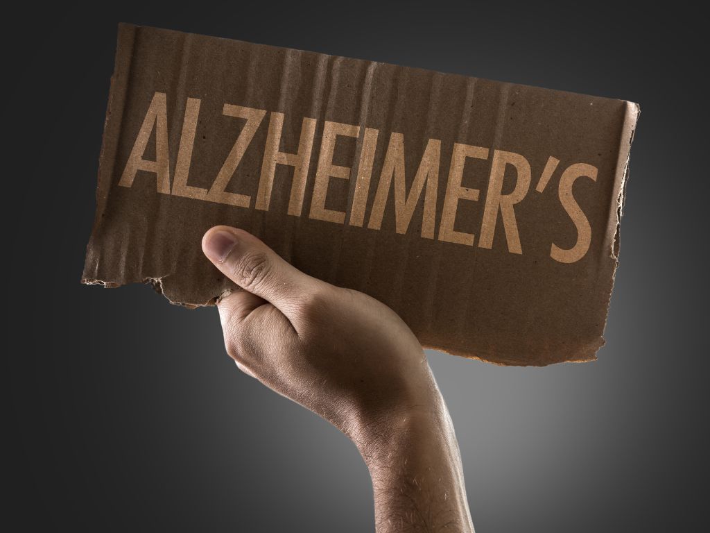 Alzheimer : Pengertian, Fakta Penting & Cara Pencegahannya